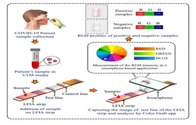 New method of visual detection of SARS-CoV-2 can identify the infection at early stage